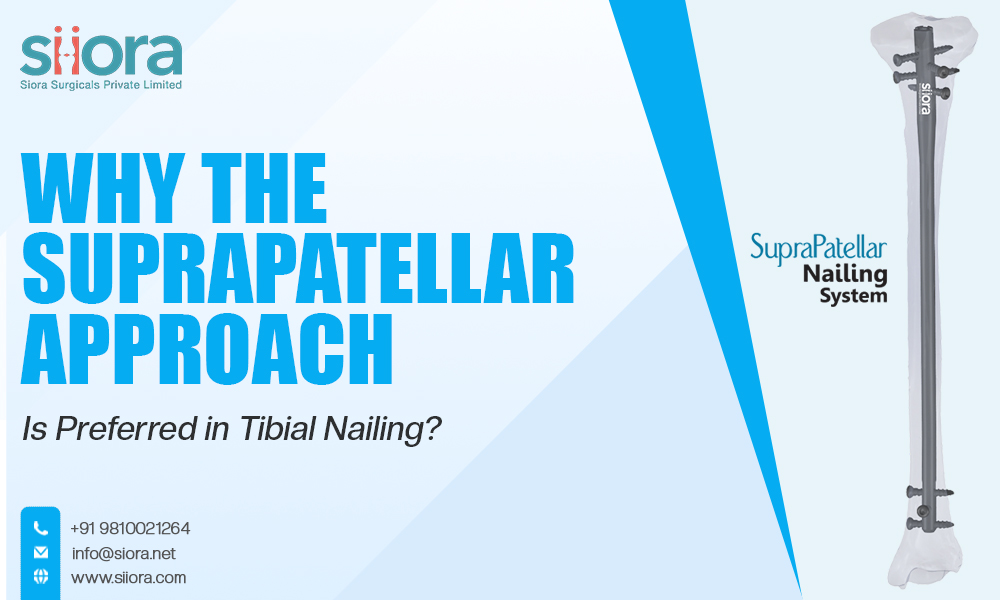 Why the Suprapatellar Approach Is Preferred in Tibial Nailing?